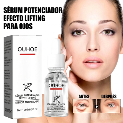 Serum quita Ojeras